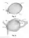 Fig. 06 - Occluder for occluding an atrial appendage and production process therefor