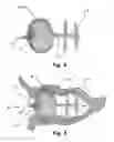 Fig. 08 - Occluder for occluding an atrial appendage and production process therefor