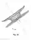 Fig. 18 - Occluder for occluding an atrial appendage and production process therefor