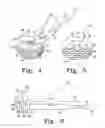 Fig. 03 - Reciprocating rasps for use in an orthopaedic surgical procedure
