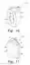 Fig. 07 - Reciprocating rasps for use in an orthopaedic surgical procedure