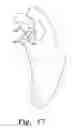 Fig. 12 - Reciprocating rasps for use in an orthopaedic surgical procedure