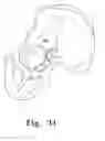 Fig. 23 - Reciprocating rasps for use in an orthopaedic surgical procedure