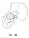 Fig. 26 - Reciprocating rasps for use in an orthopaedic surgical procedure