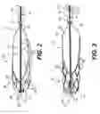 Fig. 03 - MEDICAL RETRIEVAL DEVICES AND METHODS