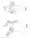Fig. 05 - Retrieval basket apparatus