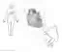 Fig. 01 - Pericardial modification systems and methods for heart failure treatment