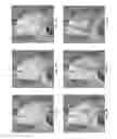 Fig. 07 - Pericardial modification systems and methods for heart failure treatment