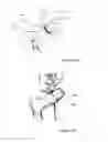 Fig. 05 - SUPPORT ELEMENT FOR CIRCUMCISION AND SYSTEM COMPRISING THE SAME