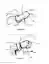 Fig. 08 - SUPPORT ELEMENT FOR CIRCUMCISION AND SYSTEM COMPRISING THE SAME