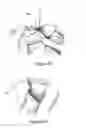 Fig. 11 - SUPPORT ELEMENT FOR CIRCUMCISION AND SYSTEM COMPRISING THE SAME