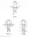 Fig. 03 - Method and apparatus for tissue copying and grafting
