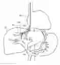 Fig. 01 - Devices and methods for intrahepatic shunts