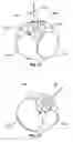 Fig. 19 - Devices and methods for intrahepatic shunts