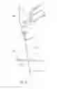 Fig. 17 - Exchanger surgical access port and methods of use