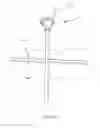 Fig. 18 - Exchanger surgical access port and methods of use
