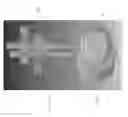 Fig. 09 - BONE POSITIONING AND CUTTING SYSTEM AND METHOD