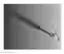 Fig. 10 - BONE POSITIONING AND CUTTING SYSTEM AND METHOD