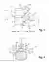 Fig. 02 - Inverted serpentine spinal stability device and associated methods