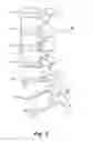 Fig. 03 - Inverted serpentine spinal stability device and associated methods