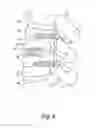 Fig. 05 - Inverted serpentine spinal stability device and associated methods