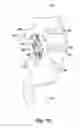 Fig. 11 - Inverted serpentine spinal stability device and associated methods