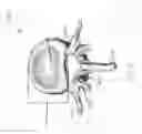 Fig. 03 - Screw clamp orthopedic device and methods of implementation