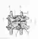 Fig. 04 - Screw clamp orthopedic device and methods of implementation