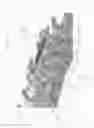 Fig. 06 - Screw clamp orthopedic device and methods of implementation