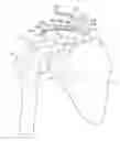 Fig. 01 - CLAVICLE FIXATION