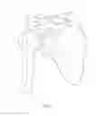 Fig. 02 - CLAVICLE FIXATION