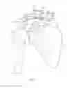 Fig. 03 - CLAVICLE FIXATION