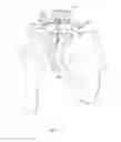 Fig. 05 - CLAVICLE FIXATION