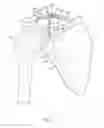 Fig. 06 - CLAVICLE FIXATION
