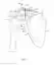 Fig. 07 - CLAVICLE FIXATION