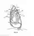 Fig. 09 - RF tissue ablation devices and methods of using the same