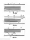 Fig. 13 - SYSTEMS AND METHODS FOR TREATING TISSUE WITH RADIOFREQUENCY ENERGY
