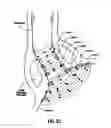 Fig. 14 - SYSTEMS AND METHODS FOR TREATING TISSUE WITH RADIOFREQUENCY ENERGY