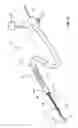 Fig. 02 - Feedback systems and methods for renal denervation utilizing balloon catheter