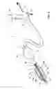 Fig. 03 - Feedback systems and methods for renal denervation utilizing balloon catheter