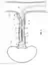 Fig. 04 - Feedback systems and methods for renal denervation utilizing balloon catheter