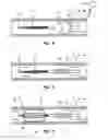 Fig. 05 - Feedback systems and methods for renal denervation utilizing balloon catheter