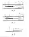 Fig. 06 - Feedback systems and methods for renal denervation utilizing balloon catheter