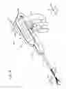 Fig. 17 - Medical manipulator with attachment limiting mechanism including counting mechanism