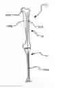 Fig. 01 - Method of manufacturing a custom arthroplasty guide