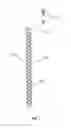 Fig. 09 - Tip tracking apparatus for medical procedures