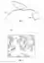 Fig. 02 - Methods for Detecting Materials in a Body Cavity