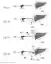 Fig. 07 - Device and method for assisting laparoscopic surgery—rule based approach