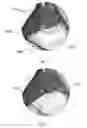 Fig. 09 - Device and method for assisting laparoscopic surgery—rule based approach