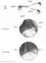 Fig. 22 - Device and method for assisting laparoscopic surgery—rule based approach